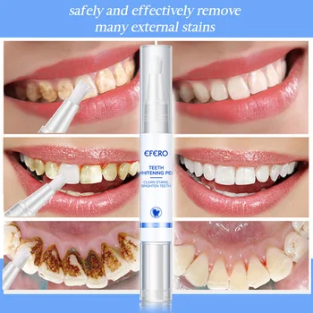 Bielenie zubov Pero Rýchle Čistenie Odstránenie Plaku Škvrny Ústnej Hygieny Nástroj MH88
