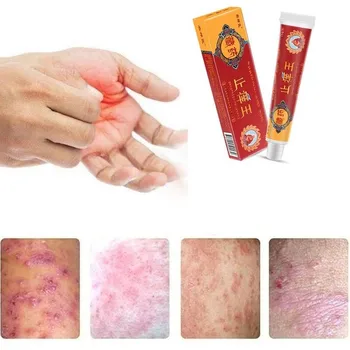 Čínske Bylinné Antibakteriálny Krém Skin Aktuálne Psoriáza Krém Dermatitídy Eczematoid Ekzém Masti, Krémy Liečby